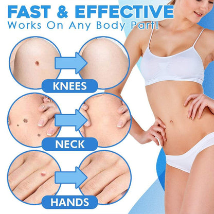 SkinShed Pro™ — Endlich glatte Haut ohne Schmerzen oder Narben in nur zwei Wochen!