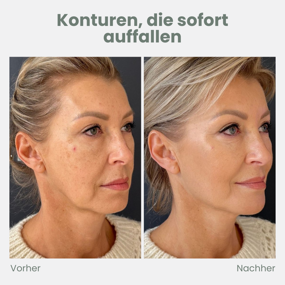LuxLift™ — Heb dein Kinn, strahle Jugendlichkeit aus ohne OP!