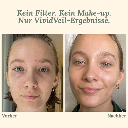 VividVeil — Deine Haut strahlt jugendlich prall und faltenfrei wie nie zuvor! (5 Stück)