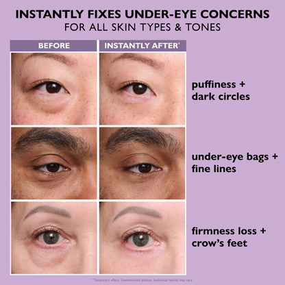VitaLuxe Lift — Entfalte deinen strahlend frischen Blick und sag müden Augen den Kampf an!