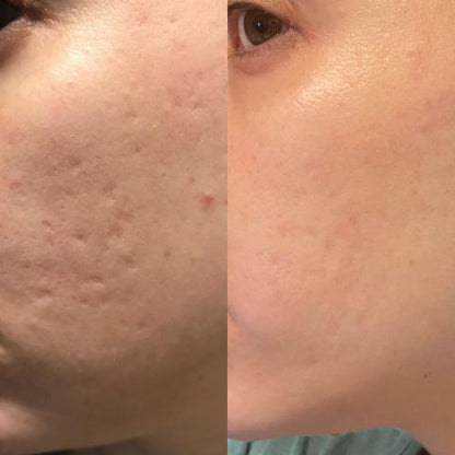 GlowArmor™ — Wach auf mit sichtbar glatter Haut und jugendlichem Strahlen