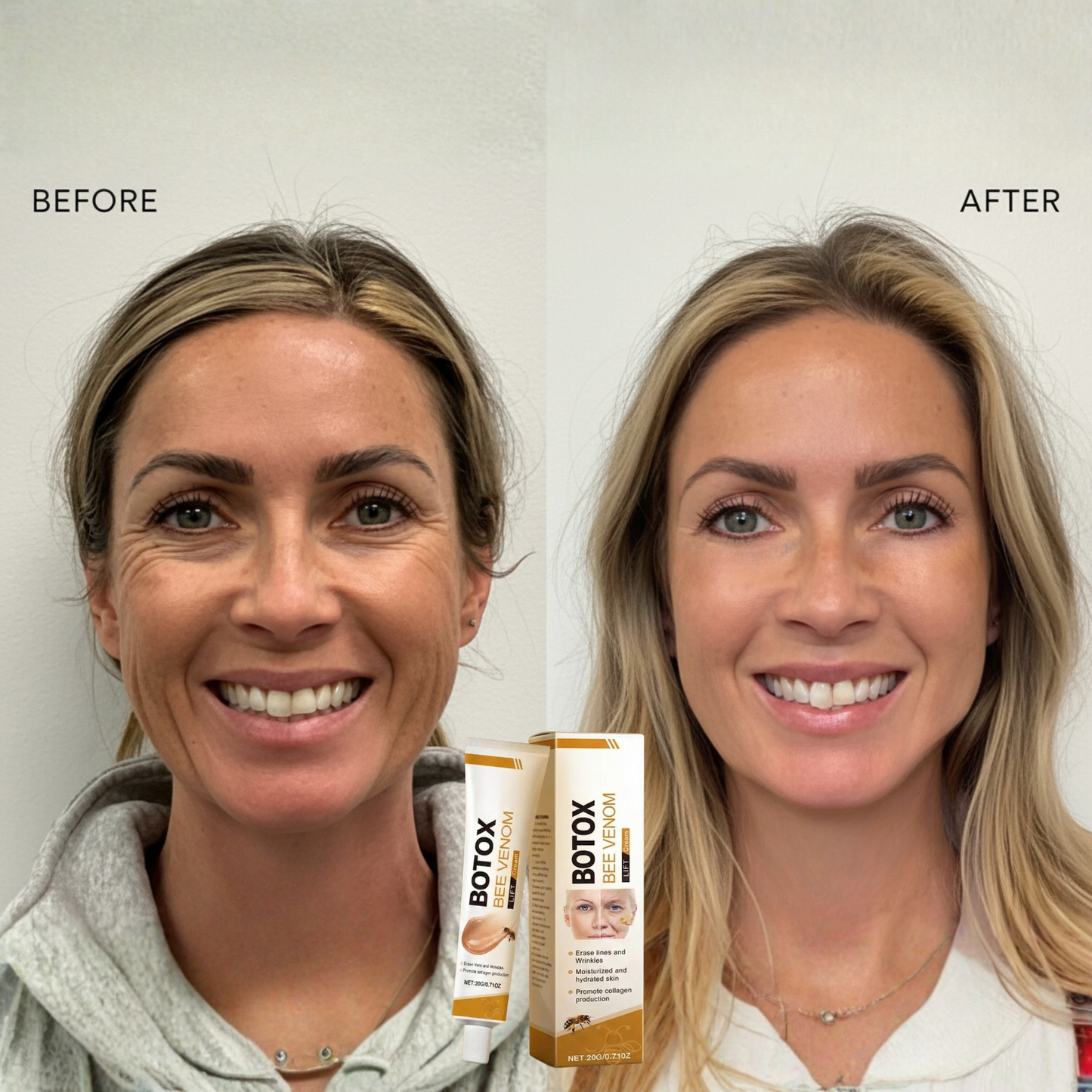VitalBiene™ — Entfalte jugendliche Straffheit und strahlende Frische ohne Nadeln!
