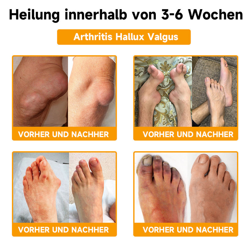 VeniFirme™ — Erwecke deine Haut zu straffer, jugendlicher Power jeden Tag!