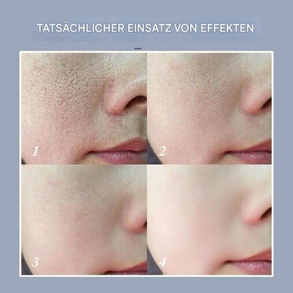 UltimaLift™ — Entfessle den strahlenden Glow, der dich jünger und unwiderstehlich macht!