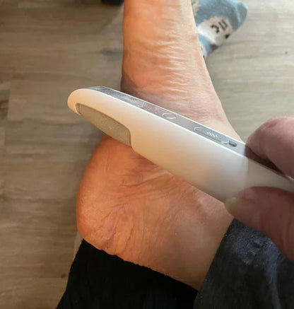 PowerWunder Fußglätter — Verabschiede Dich von Schmerz & Hornhaut für Samtweich-feeling in Minuten!