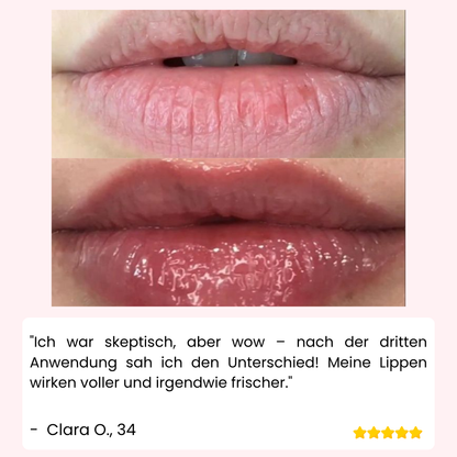 VoluPout™ — Verführerische, pralle Lippen ohne Nadeln in Minuten