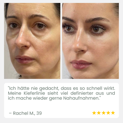 LuxLift™ — Heb dein Kinn, strahle Jugendlichkeit aus ohne OP!