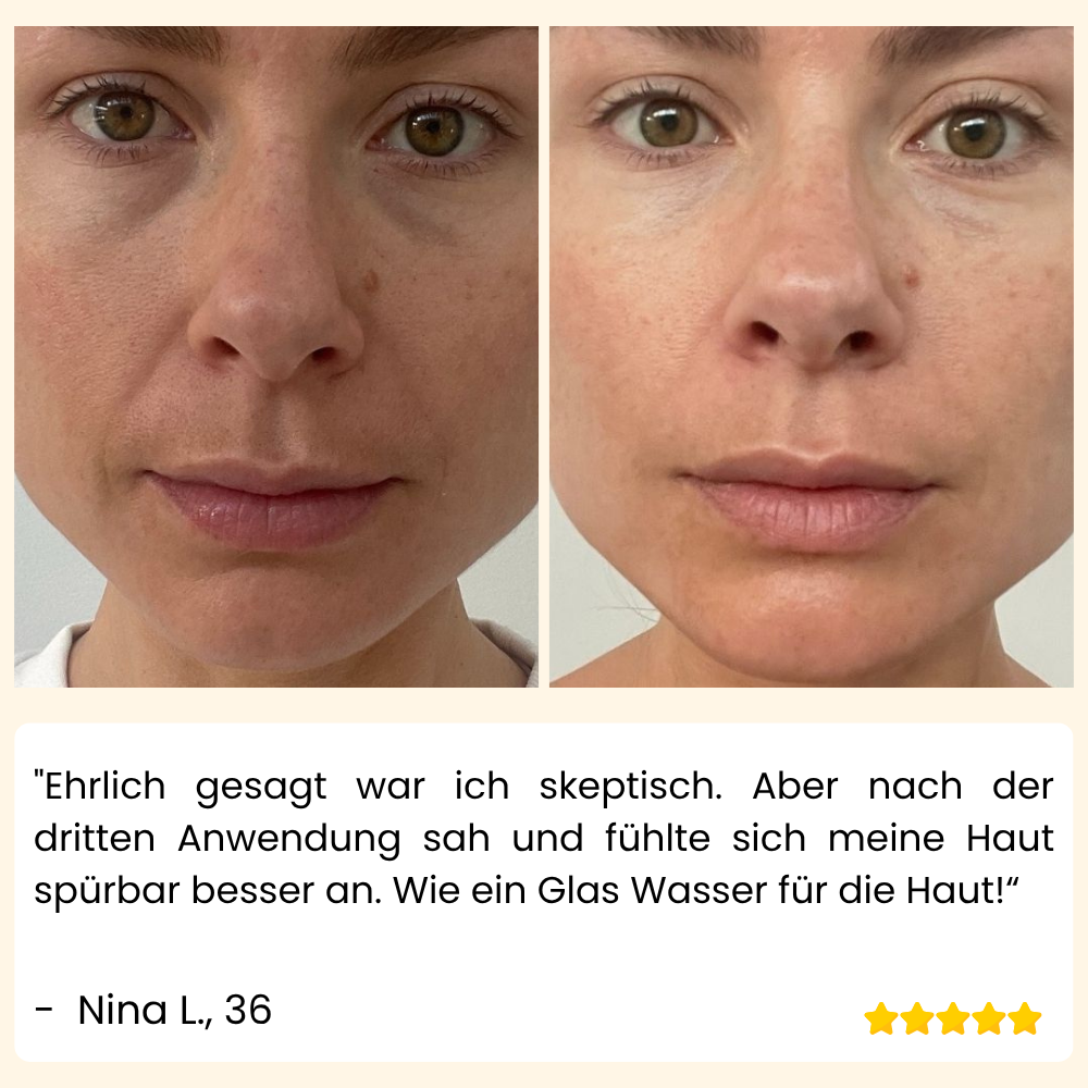 VividVeil — Deine Haut strahlt jugendlich prall und faltenfrei wie nie zuvor! (5 Stück)