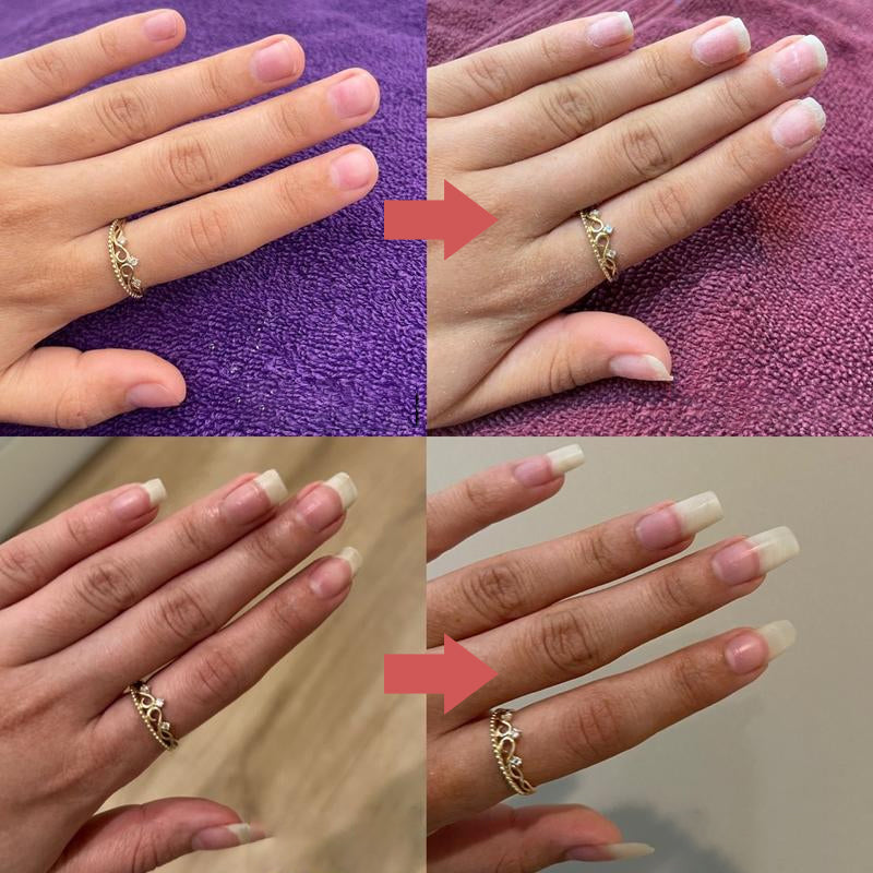 NailForce Max — Verwandelt brüchige Nägel in unwiderstehliche Kraftpakete voller Glanz und Stärke!