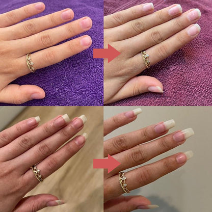 NailForce Max — Verwandelt brüchige Nägel in unwiderstehliche Kraftpakete voller Glanz und Stärke!