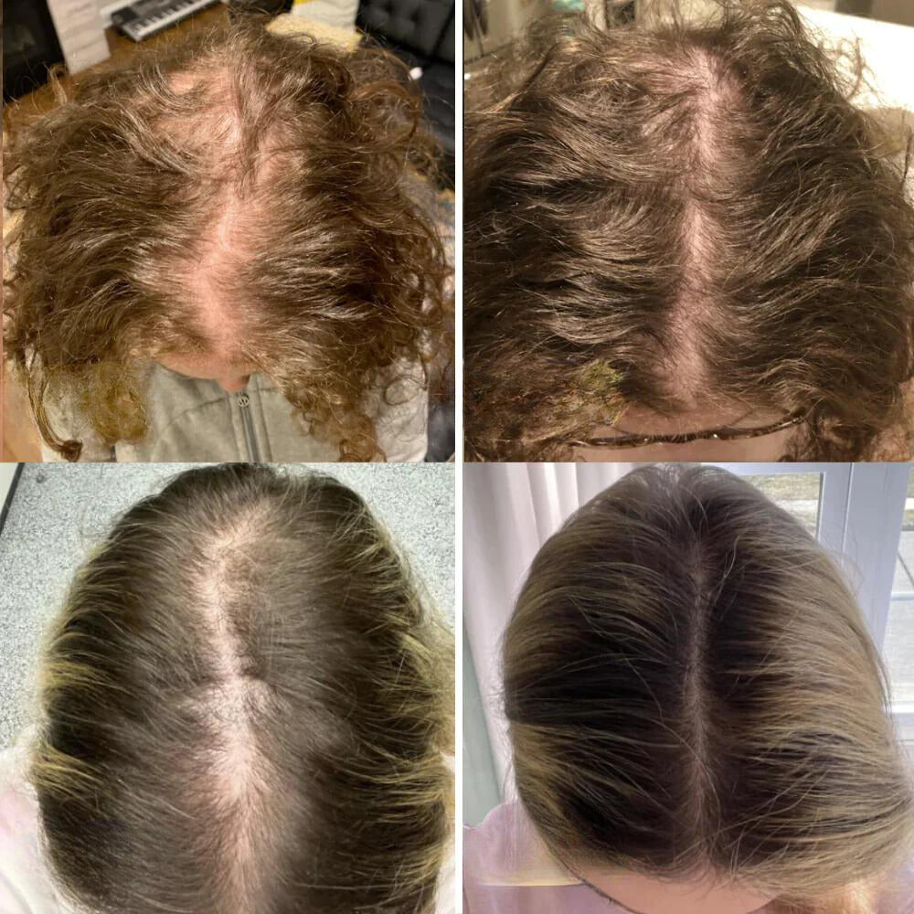 VitaFolliX — Entfache deine Haarwurzeln für eine kraftvolle, unwiderstehliche Mähne