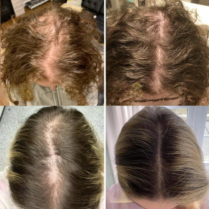 VitaFolliX — Entfache deine Haarwurzeln für eine kraftvolle, unwiderstehliche Mähne