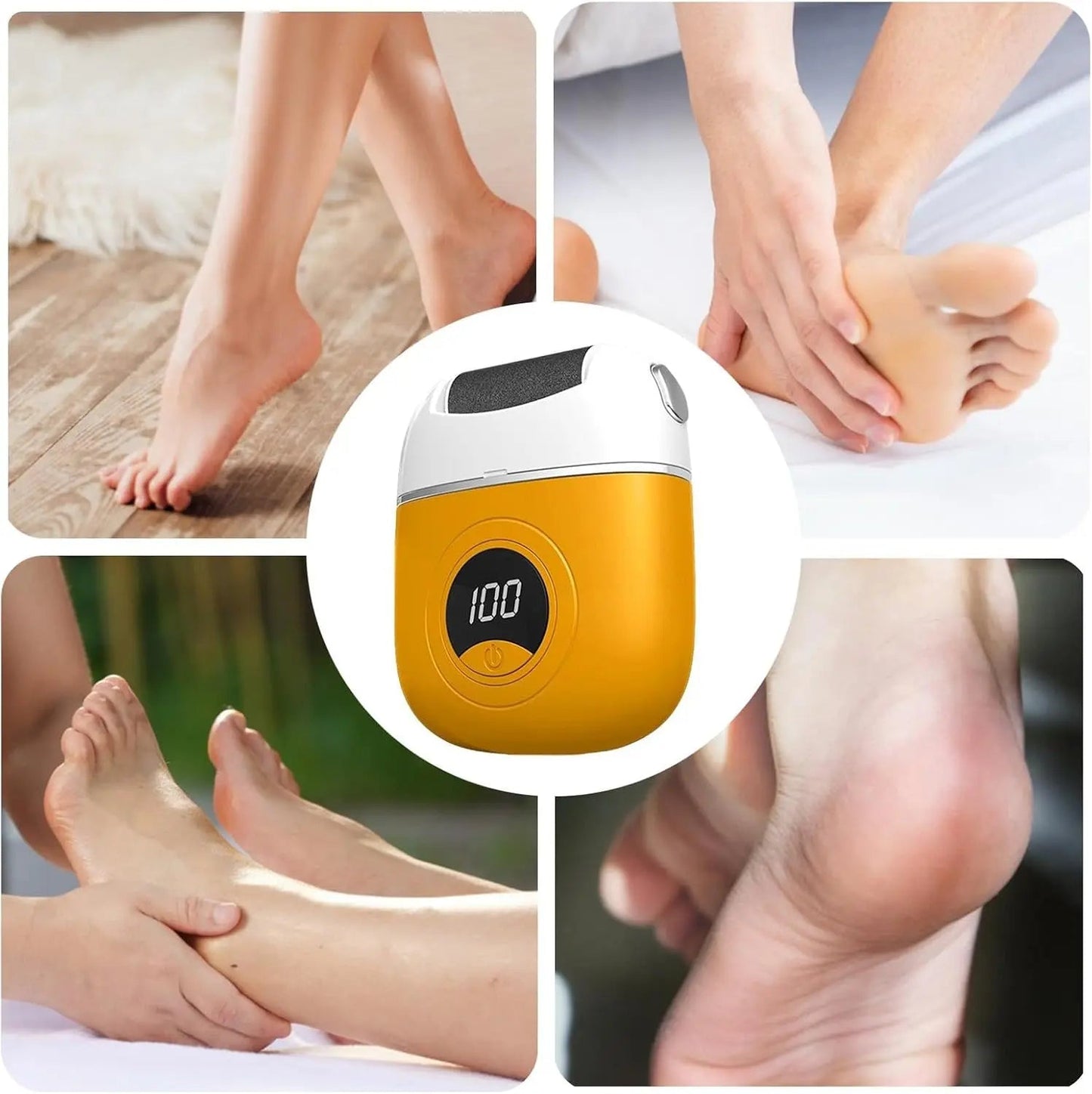 Mivoza Elektrischer Hornhautentferner — Befrei deine Füße und genieße seidenweiche Leichtigkeit bei jedem Schritt!