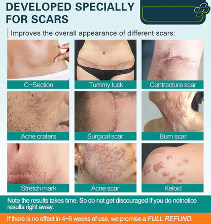 ScarVitalize — Verabschiede dich von Narben und fühl dich wieder wohl in deiner Haut!