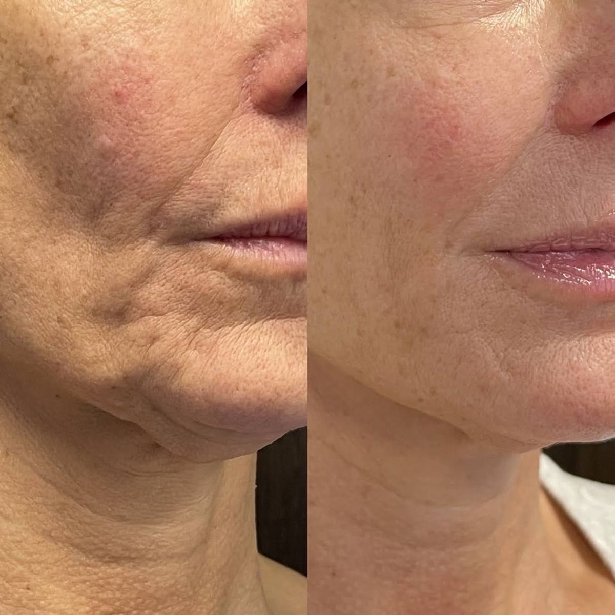 VivaLuxe Anti-Aging Serum Stick — Entfalte straffe, jugendliche Haut – sichtbar frisch und unwiderstehlich jung in Sekunden!
