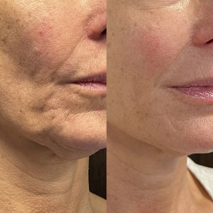 VivaLuxe Anti-Aging Serum Stick — Entfalte straffe, jugendliche Haut – sichtbar frisch und unwiderstehlich jung in Sekunden!