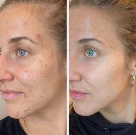 Goldstaub Serum — Entfessle Deinen Strahlend-Jungen Teint Ohne Kompromisse