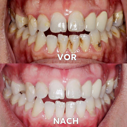 FrischeVibe™ — Spüre stundenlange Powerfrische ohne Chemie, die Bakterien wegfegt und dein Selbstbewusstsein beflügelt!