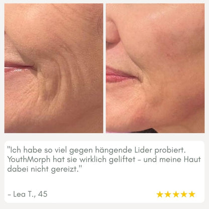 YouthMorph™ — Straffe Haut in Minuten für deinen jugendlichen WOW-Moment