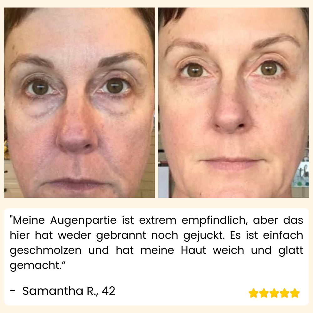 VividVeil — Deine Haut strahlt jugendlich prall und faltenfrei wie nie zuvor! (5 Stück)