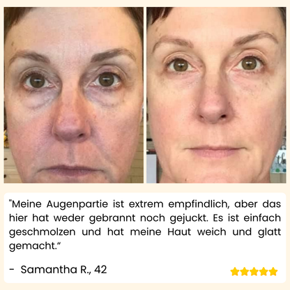 VividVeil — Deine Haut strahlt jugendlich prall und faltenfrei wie nie zuvor! (5 Stück)