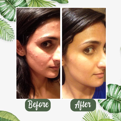 DetoxiPure™ Green Tea Deep Cleanse Mask Stick — Befrei deine Poren für ein strahlendes, frisches Hautgefühl, das alle Blicke auf sich zieht!