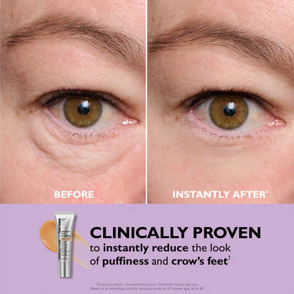 VitaLuxe Lift — Entfalte deinen strahlend frischen Blick und sag müden Augen den Kampf an!