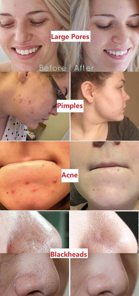 DetoxiPure™ Green Tea Deep Cleanse Mask Stick — Befrei deine Poren für ein strahlendes, frisches Hautgefühl, das alle Blicke auf sich zieht!