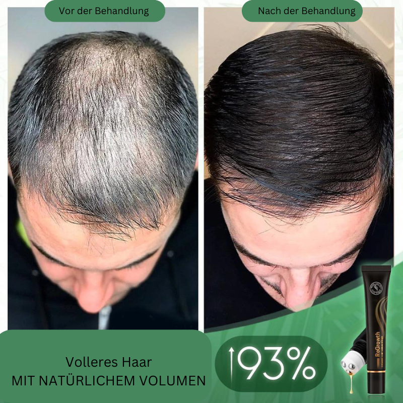 VoluMight — Entfessele volles, kraftvolles Haar und strahle Selbstbewusstsein aus!