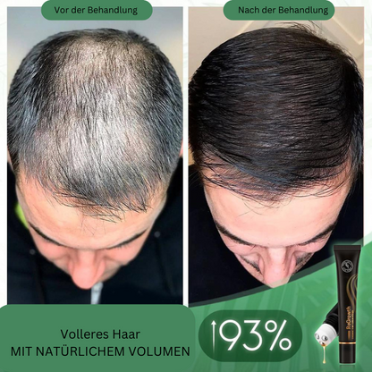 VoluMight — Entfessele volles, kraftvolles Haar und strahle Selbstbewusstsein aus!