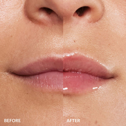 LipLuxx — Volle, Verführerische Lippen, Die Deinen Selbstbewusstsein Boostern