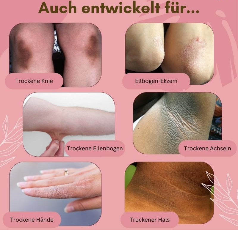 Dermashield — Schnelle Rettung für rissige, juckende Füße, die wieder frei atmen wollen