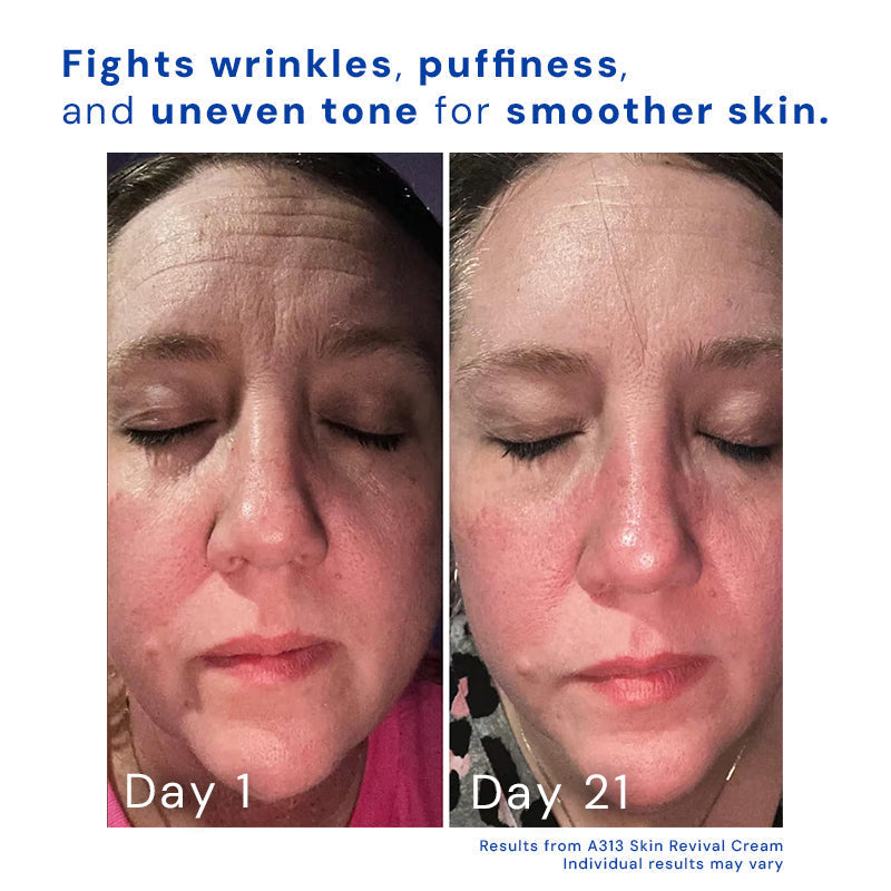 VitaLuxe Night Elixir — Wach auf mit glatter, strahlend jugendlicher Haut, die alle Blicke fesselt!