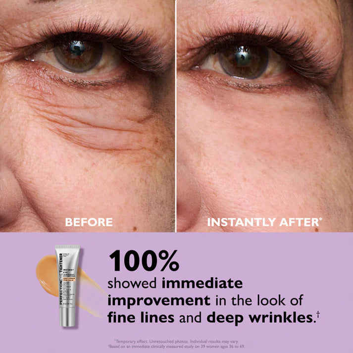 VitaLuxe Lift — Entfalte deinen strahlend frischen Blick und sag müden Augen den Kampf an!