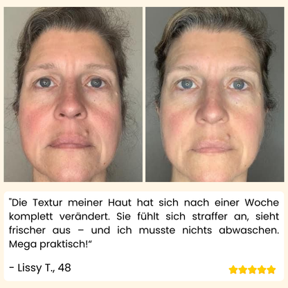 VividVeil — Deine Haut strahlt jugendlich prall und faltenfrei wie nie zuvor! (5 Stück)