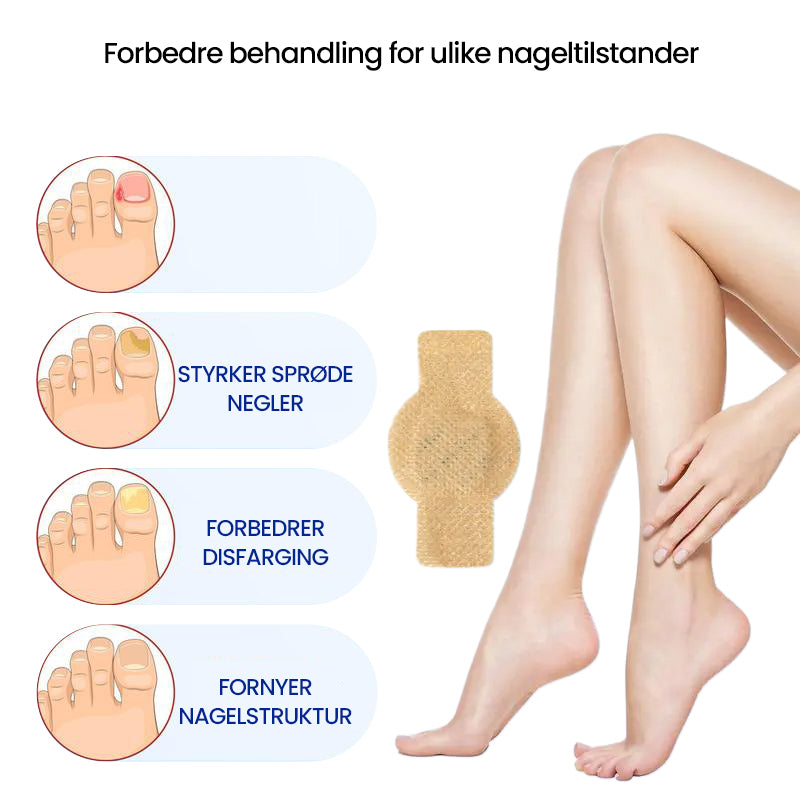 FungiGuard™ — Endlich klare Nägel und wieder selbstbewusst auftreten!