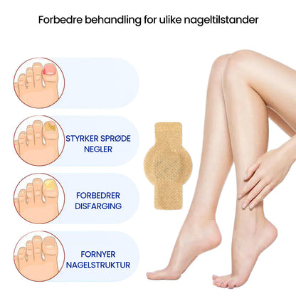 FungiGuard™ — Endlich klare Nägel und wieder selbstbewusst auftreten!