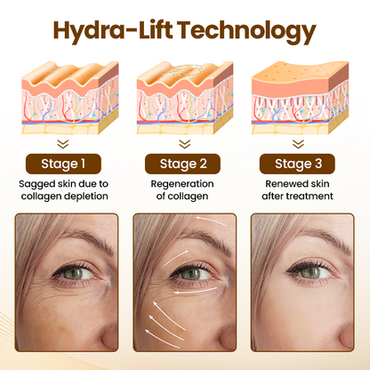 VitaLift 10s Serum — Straffe, strahlende Haut in Sekunden – fühl dich wieder jugendlich und frisch!