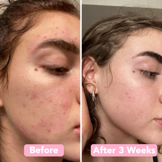 GlowFlect Radiance Pads — Strahle sofort mit jugendlicher, natürlicher Leuchtkraft ohne Chemie (40 Stück)