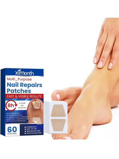 NailRescue Power-Patches — Endlich selbstbewusst mit makellos gesunden Nägeln, die keiner mehr verstecken will!