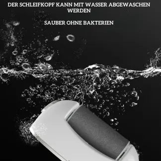 Mivoza Elektrischer Hornhautentferner — Befrei deine Füße und genieße seidenweiche Leichtigkeit bei jedem Schritt!