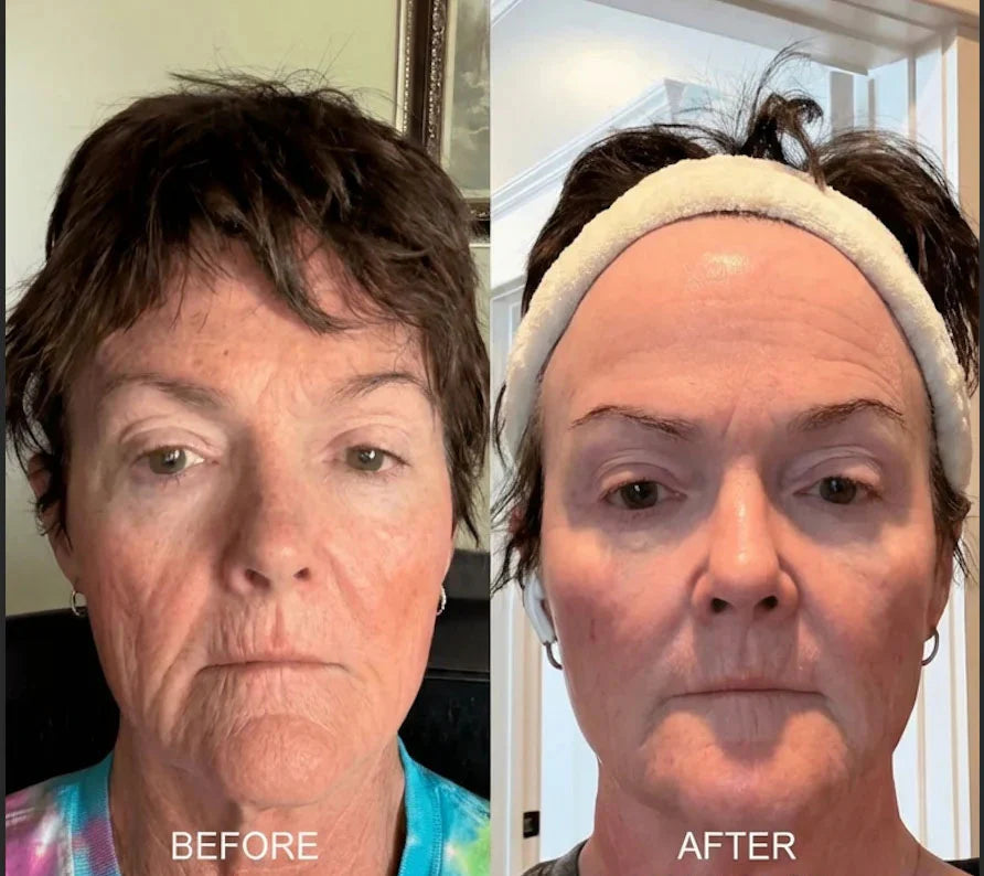 UltimateYouth Collagen Booster Serum — Erwecke deine jugendliche Strahlkraft für straffe, pralle Haut wie nie zuvor!