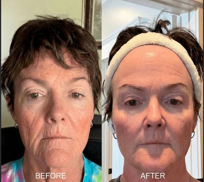 UltimateYouth Collagen Booster Serum — Erwecke deine jugendliche Strahlkraft für straffe, pralle Haut wie nie zuvor!