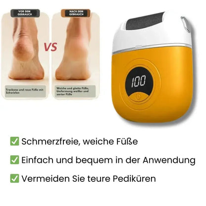 Mivoza Elektrischer Hornhautentferner — Befrei deine Füße und genieße seidenweiche Leichtigkeit bei jedem Schritt!