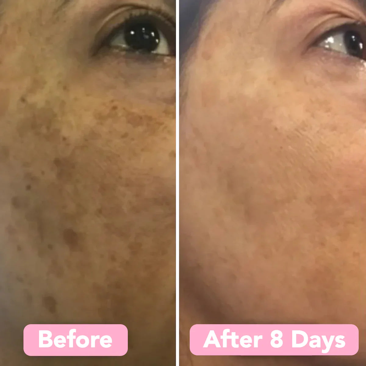 GlowFlect Radiance Pads — Strahle sofort mit jugendlicher, natürlicher Leuchtkraft ohne Chemie (40 Stück)