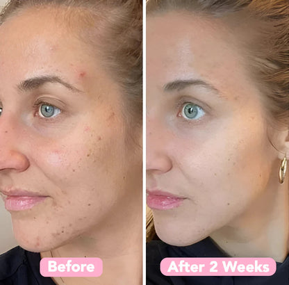 GlowFlect Radiance Pads — Strahle sofort mit jugendlicher, natürlicher Leuchtkraft ohne Chemie (40 Stück)