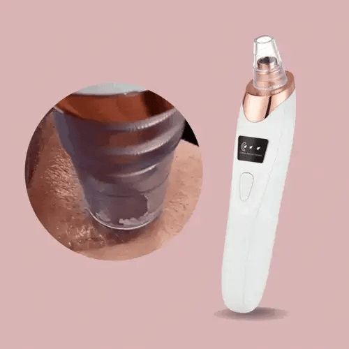 Nano Electrical Vacuum Blackhead Remover — Entfessle deine strahlend klare Haut ohne Schmerzen oder Stress
