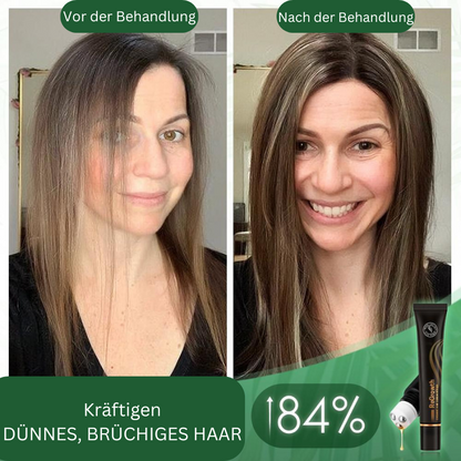 VoluMight — Entfessele volles, kraftvolles Haar und strahle Selbstbewusstsein aus!