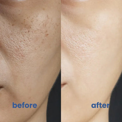 GlowVanta™ — Entfache dein strahlendes Selbstvertrauen mit makellos beruhigter Haut