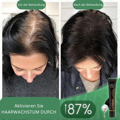 VoluMight — Entfessele volles, kraftvolles Haar und strahle Selbstbewusstsein aus!